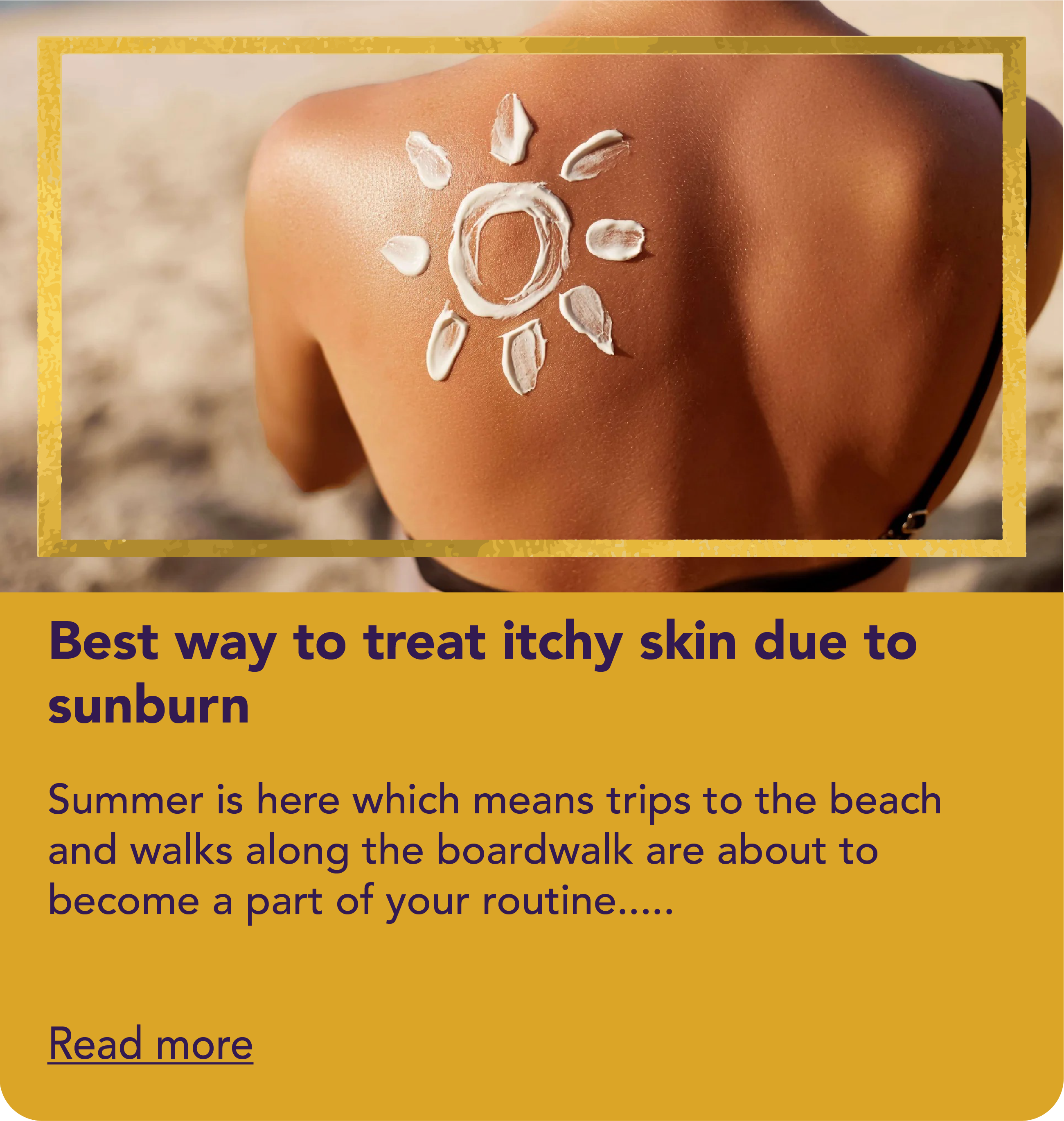 Best way to treat itchy skin due to sunburn