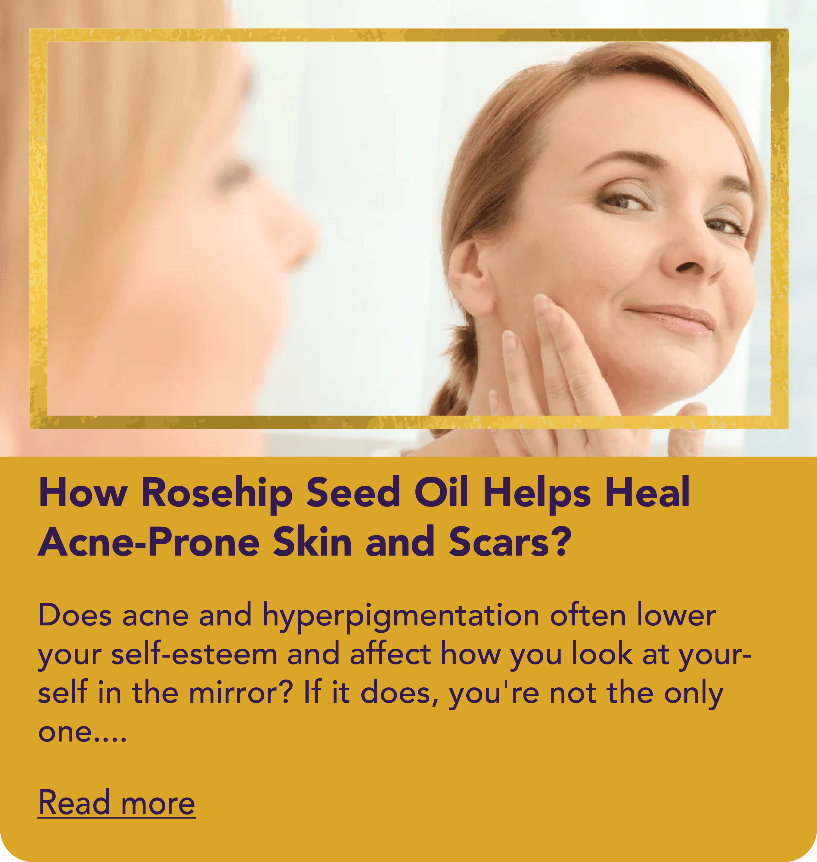 How Rosehip Seed Oil Helps Heal Acne-Prone Skin and Scars